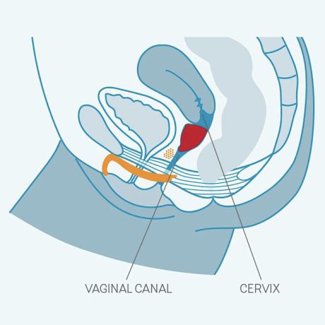 Kit de copa menstrual Explore